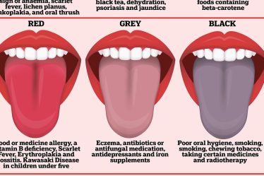 Après que le viral TikTok ait affirmé que les « fissures » sur la langue signifiaient que vous ne devriez pas boire de café, nous révélons les problèmes médicaux que vous pouvez voir en regardant dans la bouche