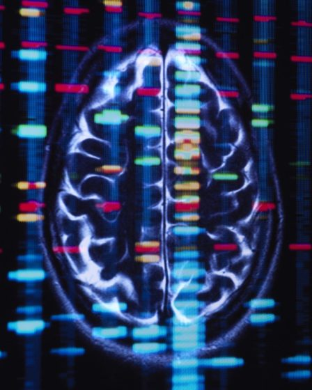 Des gènes d'ascendance africaine liés à un risque plus élevé de maladie d'Alzheimer et d'accident vasculaire cérébral : Shots