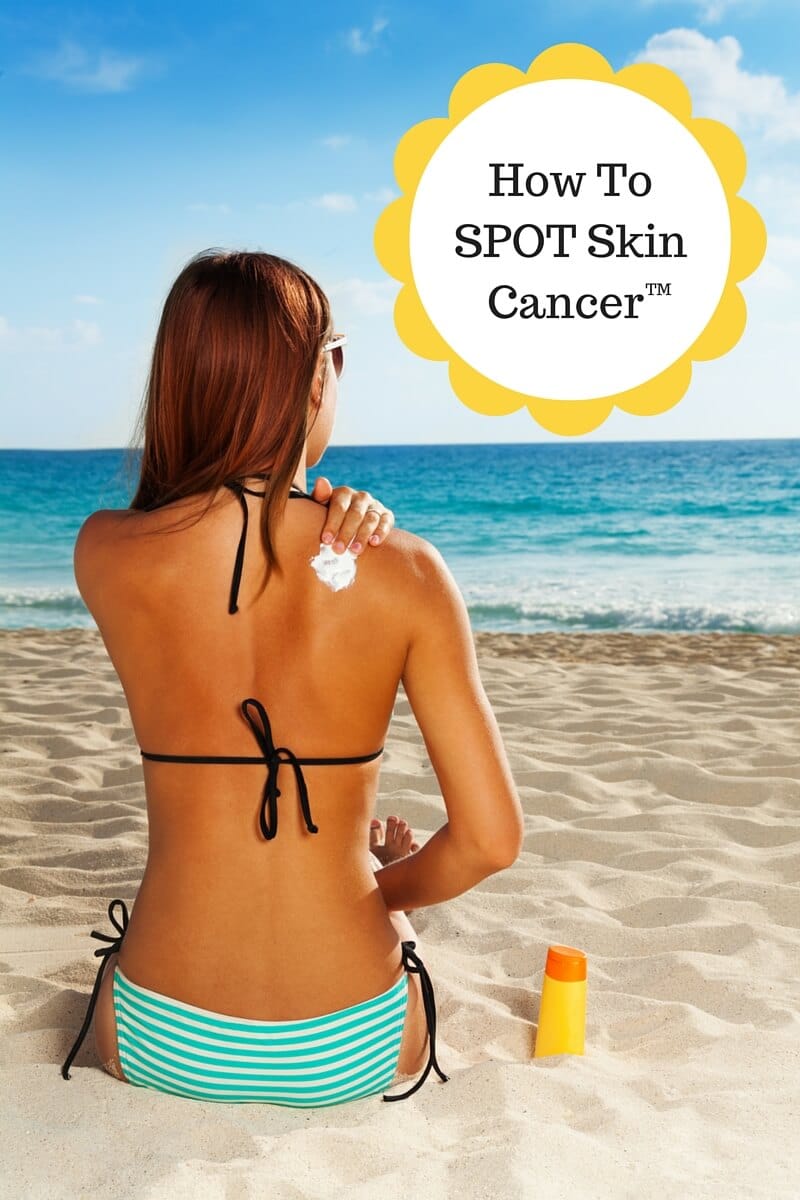 Mélanome Protection et détection du cancer de la peau #MelanomaMonday